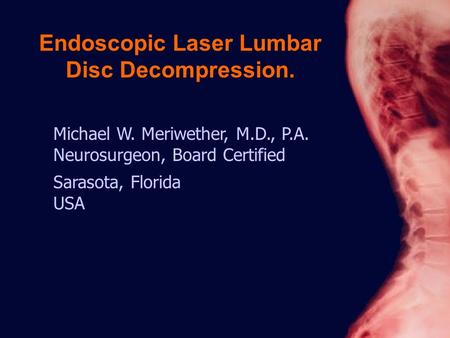 Michael W. Meriwether, M.D., P.A. Neurosurgeon, Board Certified Sarasota, Florida USA Endoscopic Laser Lumbar Disc Decompression.