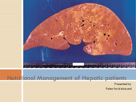 Nutritional Management of Hepatic patients