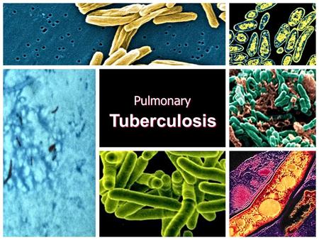 Pulmonary Tuberculosis.