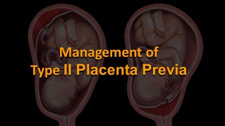 Management of Type II Placenta Previa