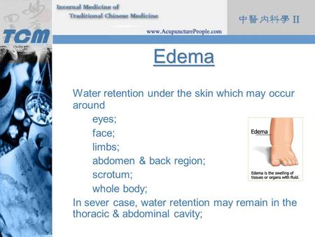 Edema Water retention under the skin which may occur around eyes;