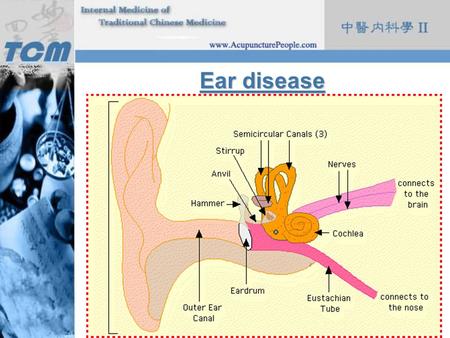 Ear disease.