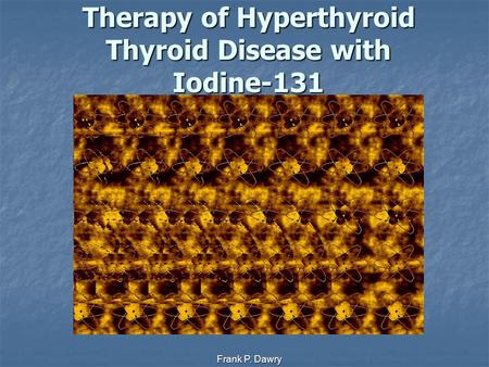 Frank P. Dawry Therapy of Hyperthyroid Thyroid Disease with Iodine-131.