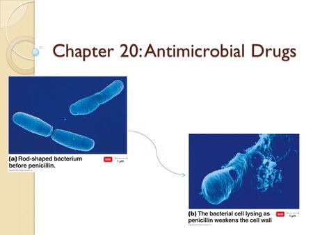 Chapter 20: Antimicrobial Drugs