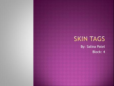 By: Salina Patel Block: 4.  Also called Acrochordons.  Skin tags are common, acquired, benign skin growths that look like a small piece of soft, hanging.
