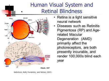 Human Visual System and Retinal Blindness Retina is a light sensitive neural network Diseases such as Retinitis Pigmentosa (RP) and Age- related Macular.