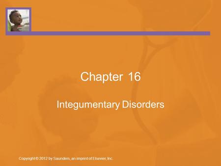 Chapter 16 Integumentary Disorders