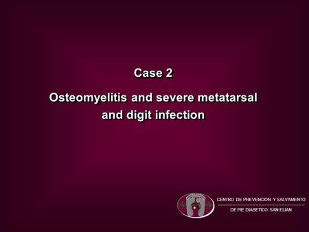 Case 2 Osteomyelitis and severe metatarsal and digit infection Case 2 Osteomyelitis and severe metatarsal and digit infection CENTRO DE PREVENCION Y SALVAMENTO.