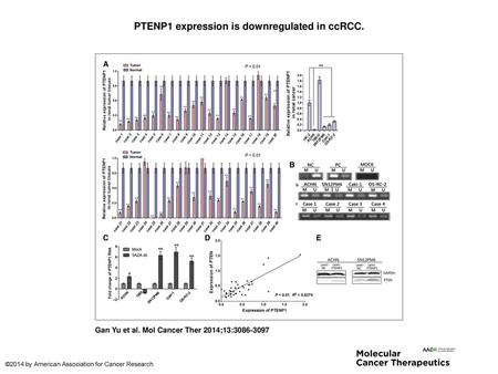 PTENP1 expression is downregulated in ccRCC.