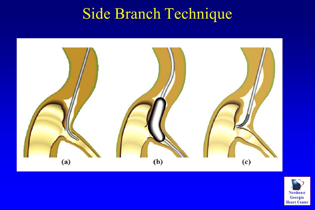 download fracture mechanics 2011