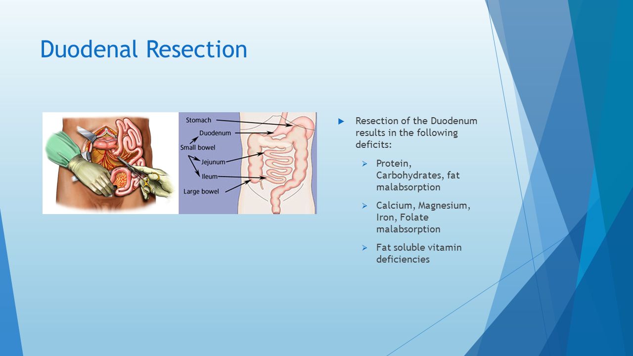 clinical mri of the abdomen