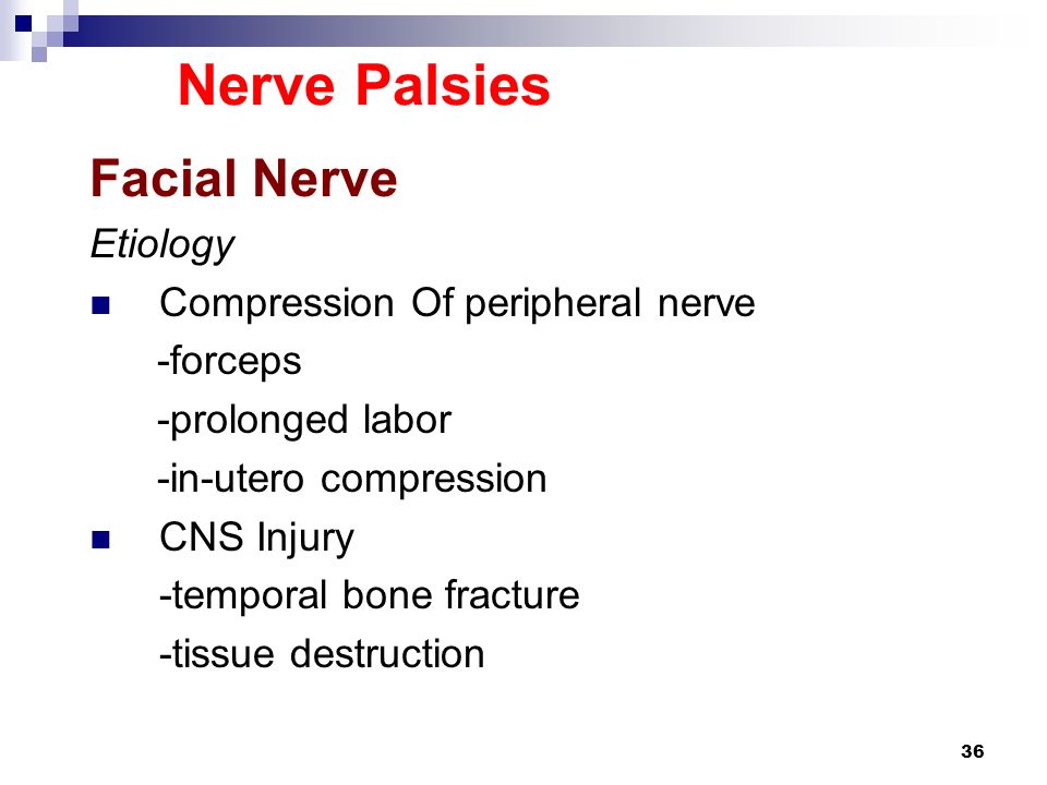 Facial Nerve Palsies 59