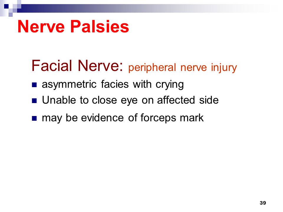 Facial Nerve Palsies 22