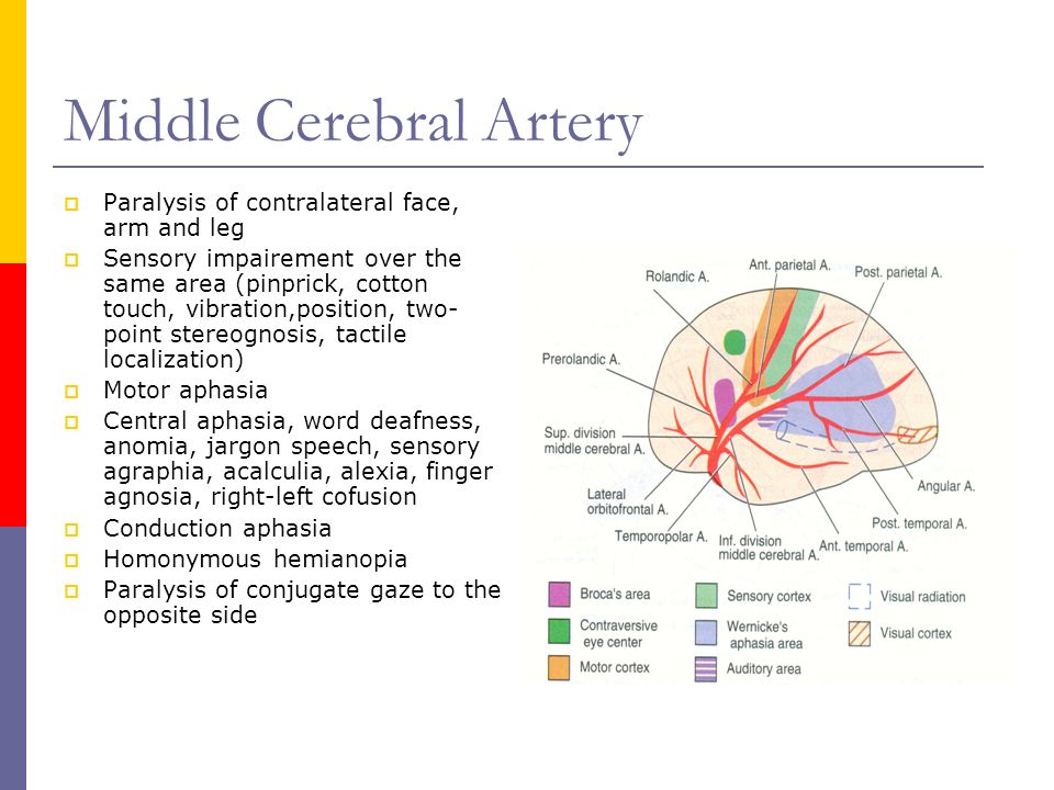 Mini stroke paralysis treating stroke with acupuncture
