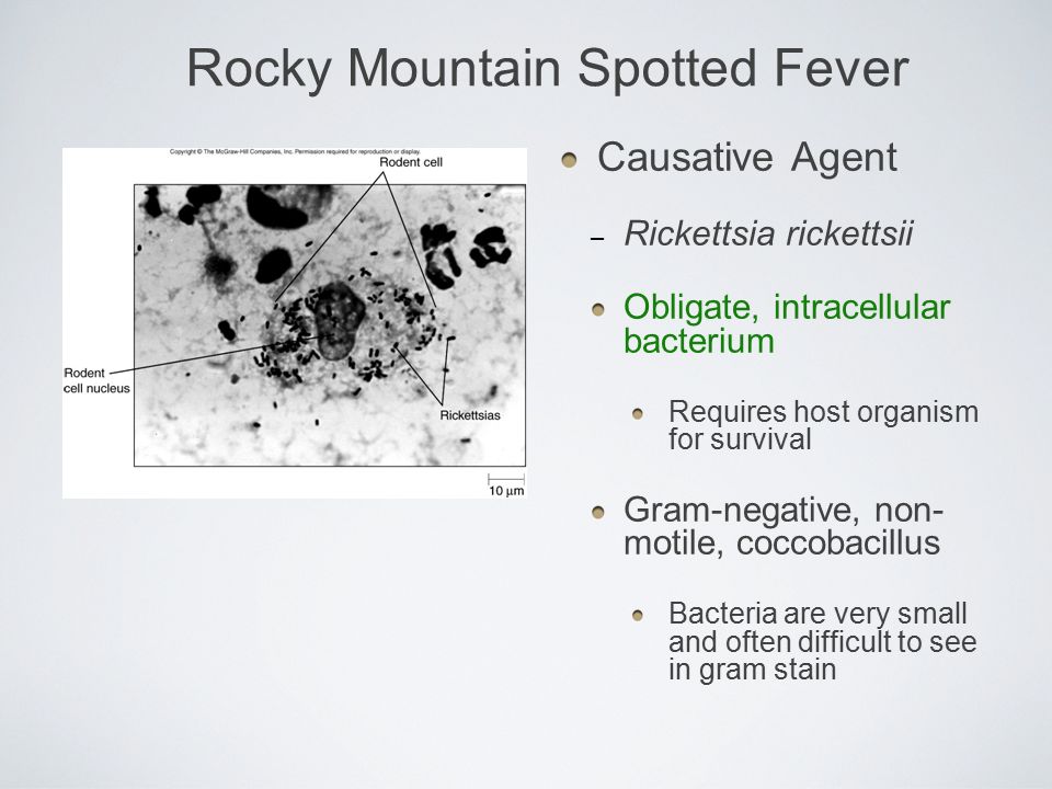 Rocky+Mountain+Spotted+Fever