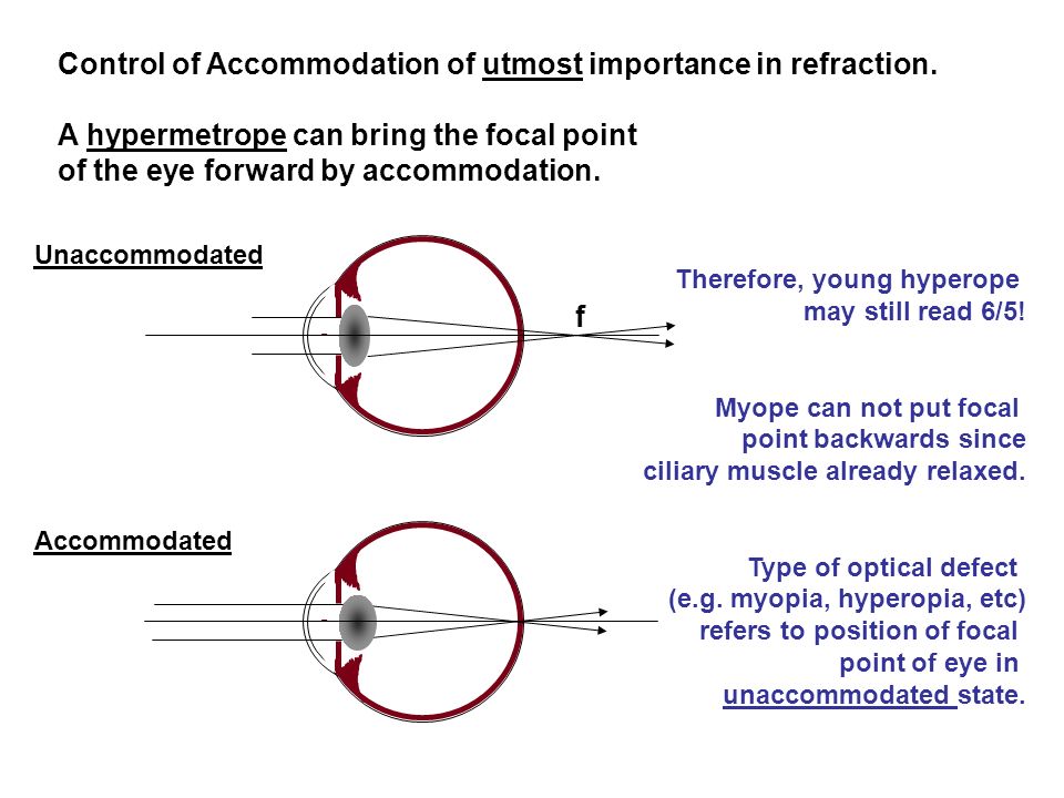 accommodation and presbyopia prof roger s anderson ppt video accommodation eye