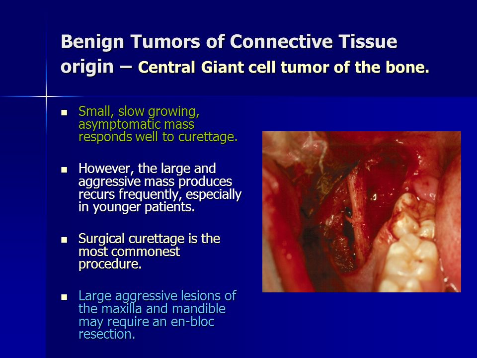 Benign Oral Tumors 40