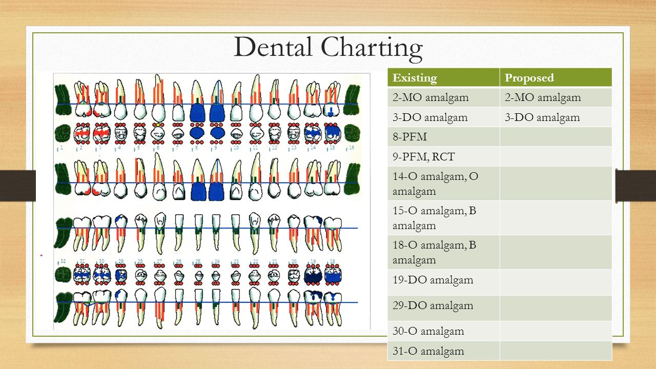 Pfm Crown Charting