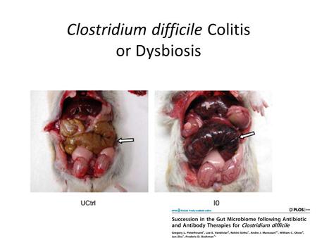 Clostridium difficile Colitis or Dysbiosis. Symbiostasis/Dysbiosis.