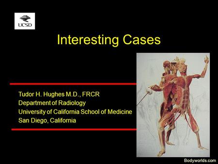Tudor H. Hughes M.D., FRCR Department of Radiology University of California School of Medicine San Diego, California Interesting Cases Bodyworlds.com.