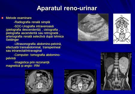 Aparatul reno-urinar Metode examinare -Radiografia renală simplă -SDC-Urografia intravenoasă (pielografia descendentă), cistografia, pielografia ascendentă.
