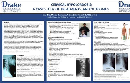 CERVICAL HYPOLORDOSIS: A CASE STUDY OF TREATMENTS AND OUTCOMES E MILY Z IPOY, M ATHEW K ALAPURAYIL, R HONDA C ROSS B EEMER P H D, ATC (M ENTOR ) Drake.