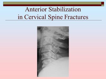 Anterior Stabilization in Cervical Spine Fractures.