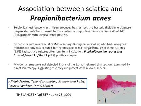 Association between sciatica and Propionibacterium acnes Serological test (exocellular antigen produced by gram-positive bacteria (lipid S)) to diagnose.