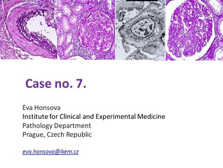 Case no. 7. Eva Honsova Institute for Clinical and Experimental Medicine Pathology Department Prague, Czech Republic