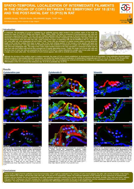 SPATIO-TEMPORAL LOCALIZATION OF INTERMEDIATE FILAMENTS IN THE ORGAN OF CORTI BETWEEN THE EMBRYONIC DAY 18 (E18) AND THE POST-NATAL DAY 15 (P15) IN RAT.