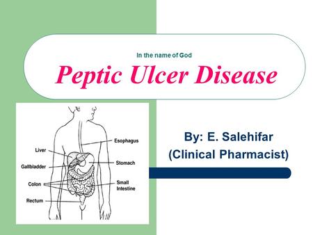 In the name of God Peptic Ulcer Disease