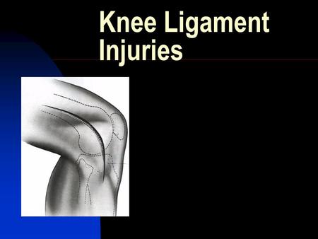 Knee Ligament Injuries. Overview Ligament Anatomy Biomechanics Ligament Specific  Epidemiology  Classification  Clinical exam  Imaging  Tx.