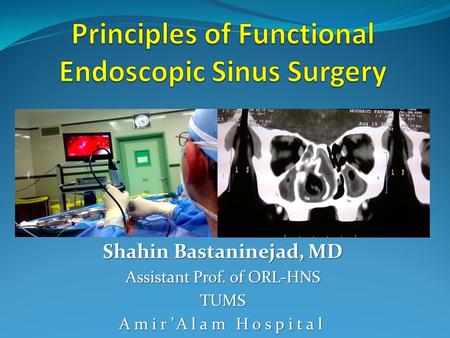 Principles of Functional Endoscopic Sinus Surgery