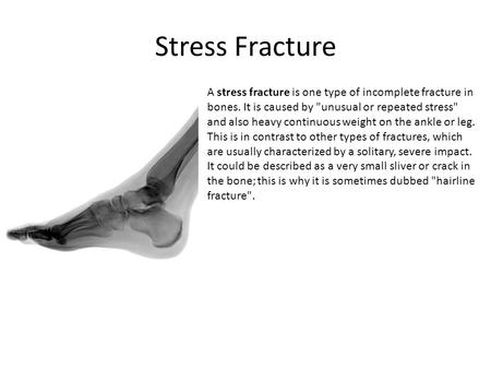 Stress Fracture A stress fracture is one type of incomplete fracture in bones. It is caused by unusual or repeated stress and also heavy continuous weight.