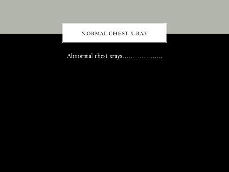 Abnormal chest xrays……………….