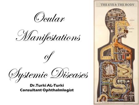 THE EYE & THE BODY Ocular Manifestations of Systemic Diseases Dr.Turki AL-Turki Consultant Ophthalmlogist.