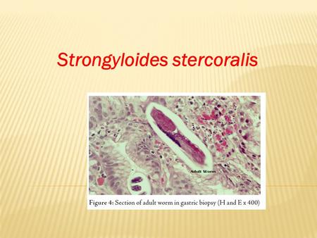 Strongyloides stercoralis