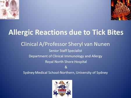 Allergic Reactions due to Tick Bites Clinical A/Professor Sheryl van Nunen Senior Staff Specialist Department of Clinical Immunology and Allergy Royal.
