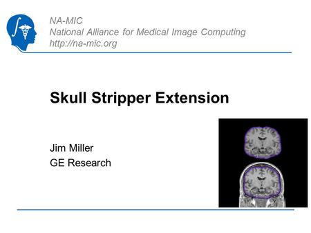 NA-MIC National Alliance for Medical Image Computing  Skull Stripper Extension Jim Miller GE Research.