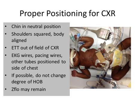 Proper Positioning for CXR Chin in neutral position Shoulders squared, body aligned ETT out of field of CXR EKG wires, pacing wires, other tubes positioned.