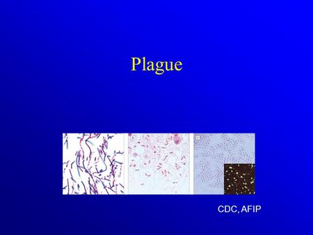Plague CDC, AFIP. Diseases of Bioterrorist Potential Learning Objectives Describe the epidemiology, mode of transmission, and presenting symptoms of disease.