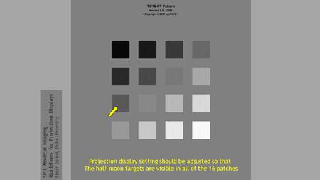 Projection display setting should be adjusted so that The half-moon targets are visible in all of the 16 patches SPIE Medical Imaging Guidelines for Projection.