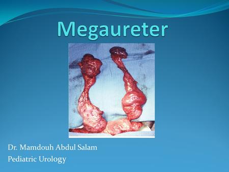 Dr. Mamdouh Abdul Salam Pediatric Urology