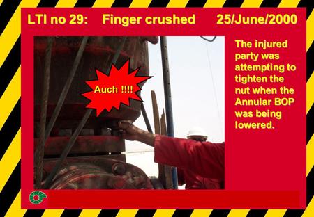 The injured party was attempting to tighten the nut when the Annular BOP was being lowered. LTI no 29: Finger crushed 25/June/2000 Auch !!!!