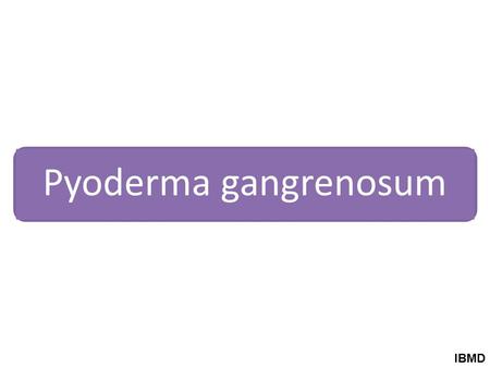 Pyoderma gangrenosum IBMD. Primary Pyoderma gangrenosum.