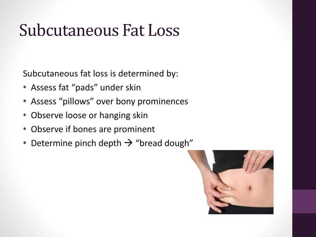 Loss Of Subcutaneous Fat 118