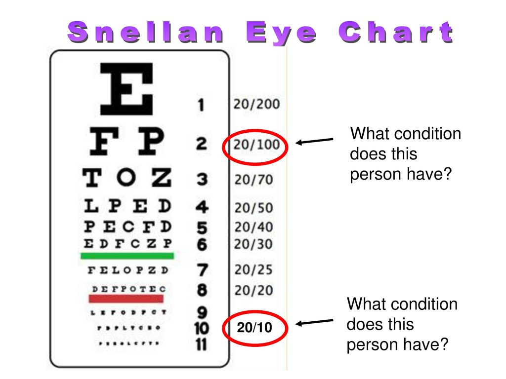 What Eye Chart Does The Dmv Use