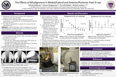 The Effects of Misalignment in Medial/Lateral and Anterior/Posterior Foot X-rays Patrick Willauer 1,2 ; Bruce Sangeorzan 1,2 ; Eric Whittaker 1 ; William.