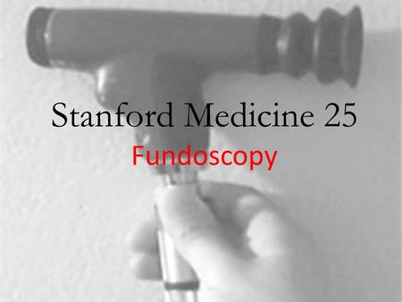 Stanford Medicine 25 Fundoscopy. Papilledema Fundoscopic Findings: – Venous engorgement/hyperemia – Loss of venous pulsations (nrml in 20- 30%)
