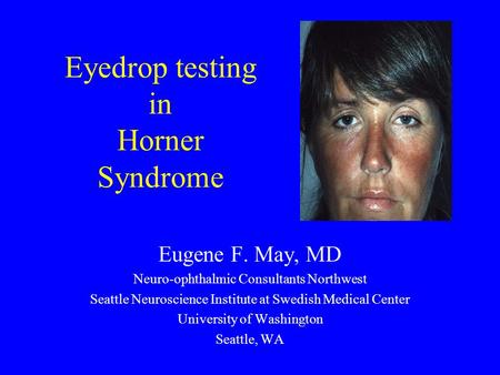 Eyedrop testing in Horner Syndrome Eugene F. May, MD Neuro-ophthalmic Consultants Northwest Seattle Neuroscience Institute at Swedish Medical Center University.